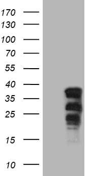 SOX21 Antibody (OTI7D5) Western Blot;SOX21 Antibody (OTI7D5)[NBP3-44903]-