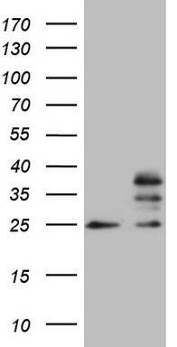 MRPS15 Antibody (OTI6D2) Western Blot;MRPS15 Antibody (OTI6D2)[NBP3-44909]-