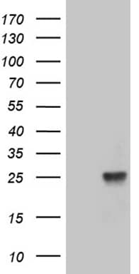 TEX30 Antibody (OTI7C3)