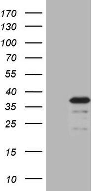 MRPS15 Antibody (OTI5F5) Western Blot;MRPS15 Antibody (OTI5F5)[NBP3-44911]-