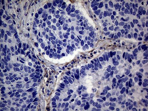 PMP22 Antibody (OTI5D1) Immunohistochemistry;PMP22 Antibody (OTI5D1)[NBP3-44912]-