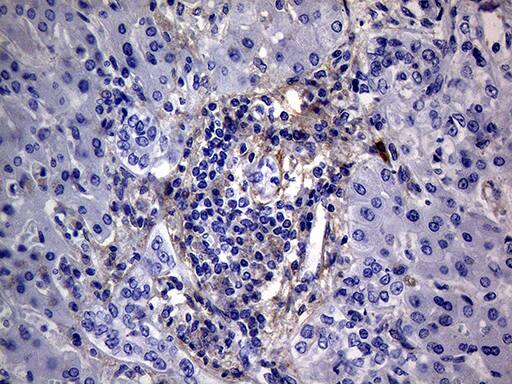 PMP22 Antibody (OTI5D1) Immunohistochemistry;PMP22 Antibody (OTI5D1)[NBP3-44912]-