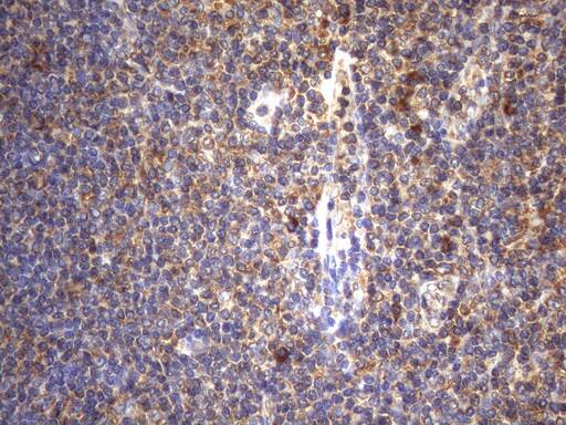 Cytohesin 2 Antibody (OTI4D9)