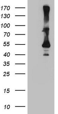 Cytohesin 2 Antibody (OTI4D9)
