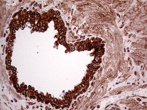 ERLIN1 Antibody (OTI4B1) Immunohistochemistry;ERLIN1 Antibody (OTI4B1)[NBP3-44916]-