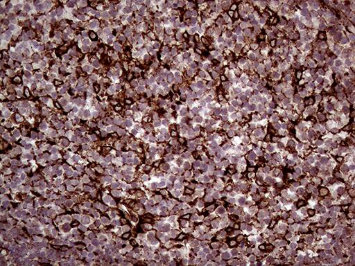 ERLIN1 Antibody (OTI4B1) Immunohistochemistry;ERLIN1 Antibody (OTI4B1)[NBP3-44916]-