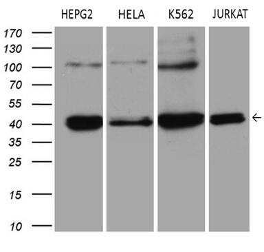 ERLIN1 Antibody (OTI4B1) Western Blot;ERLIN1 Antibody (OTI4B1)[NBP3-44916]-