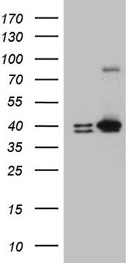 ERLIN1 Antibody (OTI4B1) Western Blot;ERLIN1 Antibody (OTI4B1)[NBP3-44916]-