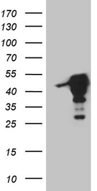 MAGEB4 Antibody (OTI3A6) Western Blot;MAGEB4 Antibody (OTI3A6)[NBP3-44920]-