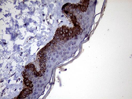 P4HA3 Antibody (OTI9A2) Immunohistochemistry;P4HA3 Antibody (OTI9A2)[NBP3-44922]-