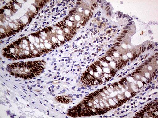 MAGEB4 Antibody (OTI1B5) Immunohistochemistry;MAGEB4 Antibody (OTI1B5)[NBP3-44925]-