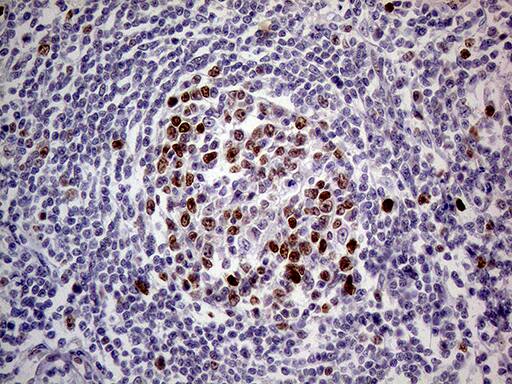 MAGEB4 Antibody (OTI1B5) Immunohistochemistry;MAGEB4 Antibody (OTI1B5)[NBP3-44925]-