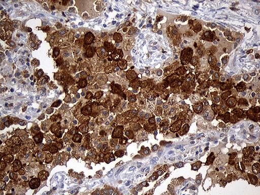 GRB7 Antibody (OTI6H2)