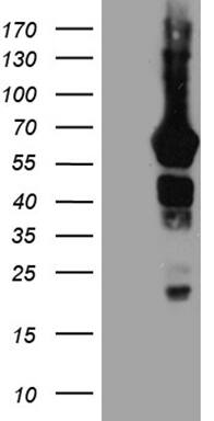 GRB7 Antibody (OTI6H2)