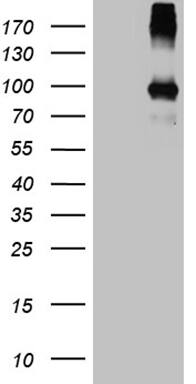 PAMR1 Antibody (OTI4E2)