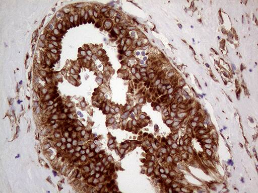 HABP2 Antibody (OTI8D6)