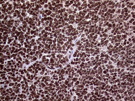TRMT5 Antibody (OTI1B5)