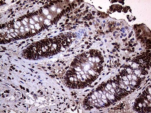 TRMT5 Antibody (OTI1B5) Immunohistochemistry;TRMT5 Antibody (OTI1B5)[NBP3-44935]-