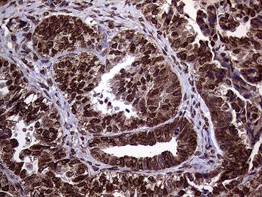 TRMT5 Antibody (OTI1B5) Immunohistochemistry;TRMT5 Antibody (OTI1B5)[NBP3-44935]-
