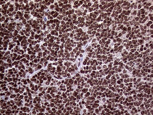 TRMT5 Antibody (OTI1B5) Immunohistochemistry;TRMT5 Antibody (OTI1B5)[NBP3-44935]-