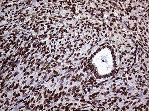 TRMT5 Antibody (OTI1B5) Immunohistochemistry;TRMT5 Antibody (OTI1B5)[NBP3-44935]-
