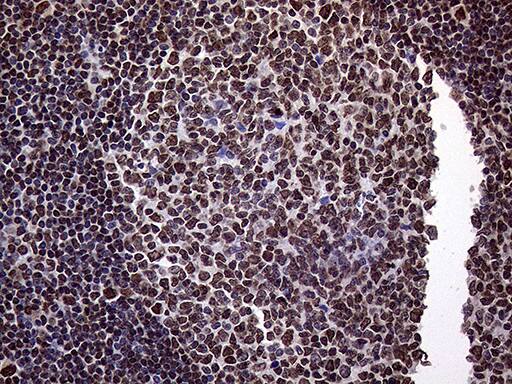 TRMT5 Antibody (OTI1B5) Immunohistochemistry;TRMT5 Antibody (OTI1B5)[NBP3-44935]-