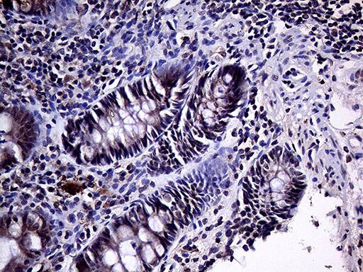 HABP2 Antibody (OTI5H3)