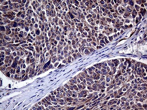 HABP2 Antibody (OTI5H3)