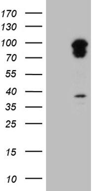 TRAFD1 Antibody (OTI3E8) Western Blot;TRAFD1 Antibody (OTI3E8)[NBP3-44943]-