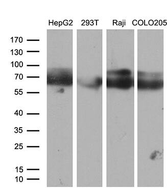 CACNB1 Antibody (OTI3H6)