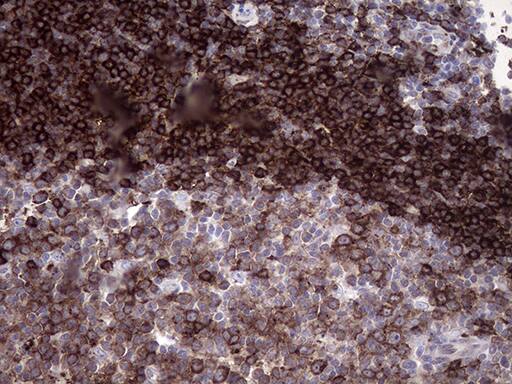 RAB23 Antibody (OTI2A8) Immunohistochemistry;RAB23 Antibody (OTI2A8)[NBP3-44946]-