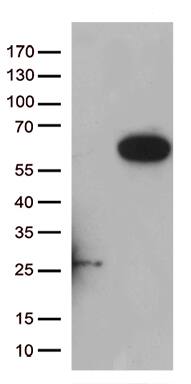 PAMCI Antibody (OTI5E5)