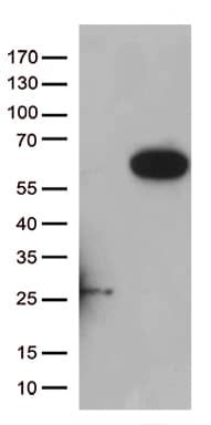PAMCI Antibody (OTI5E5) Western Blot;PAMCI Antibody (OTI5E5)[NBP3-44948]-