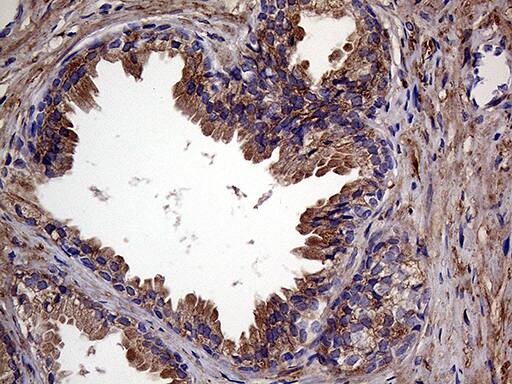 RAB23 Antibody (OTI4C7) Immunohistochemistry;RAB23 Antibody (OTI4C7)[NBP3-44949]-