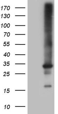 RAB23 Antibody (OTI4C7) Western Blot;RAB23 Antibody (OTI4C7)[NBP3-44949]-
