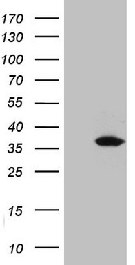 UCK2 Antibody (OTI21A6)