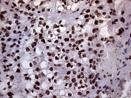 XRN2 Antibody (OTI5F4) Immunohistochemistry;XRN2 Antibody (OTI5F4)[NBP3-44953]-