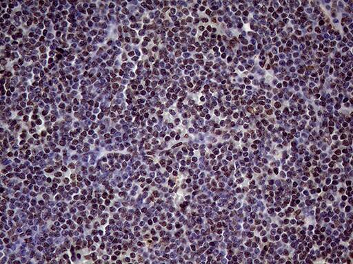 XRN2 Antibody (OTI5F4) Immunohistochemistry;XRN2 Antibody (OTI5F4)[NBP3-44953]-