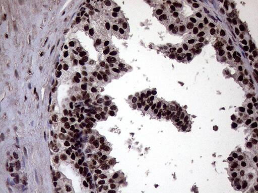 XRN2 Antibody (OTI5F4) Immunohistochemistry;XRN2 Antibody (OTI5F4)[NBP3-44953]-
