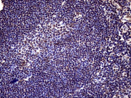 XRN2 Antibody (OTI5F4) Immunohistochemistry;XRN2 Antibody (OTI5F4)[NBP3-44953]-
