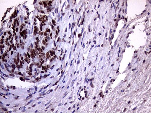 XRN2 Antibody (OTI5F4) Immunohistochemistry;XRN2 Antibody (OTI5F4)[NBP3-44953]-