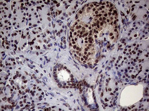 XRN2 Antibody (OTI5F4) Immunohistochemistry;XRN2 Antibody (OTI5F4)[NBP3-44953]-