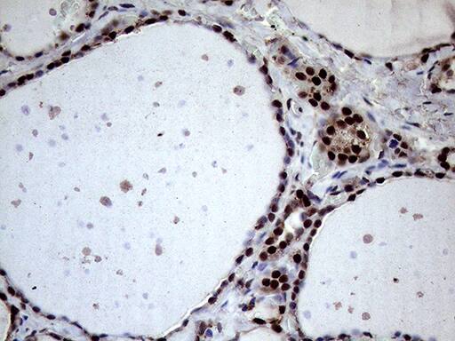 XRN2 Antibody (OTI5F4) Immunohistochemistry;XRN2 Antibody (OTI5F4)[NBP3-44953]-