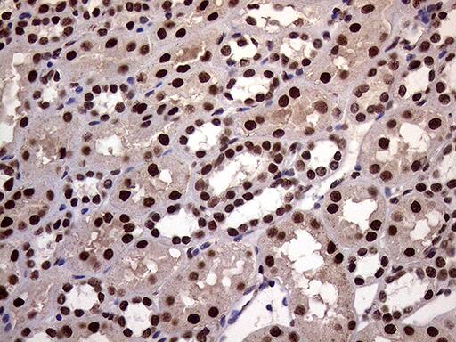 XRN2 Antibody (OTI5F4) Immunohistochemistry;XRN2 Antibody (OTI5F4)[NBP3-44953]-
