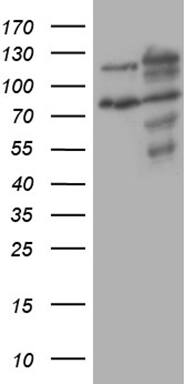 XRN2 Antibody (OTI5F4) Western Blot;XRN2 Antibody (OTI5F4)[NBP3-44953]-