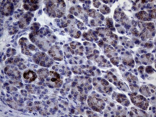 CLIP4 Antibody (OTI5D10) Immunohistochemistry;CLIP4 Antibody (OTI5D10)[NBP3-44957]-