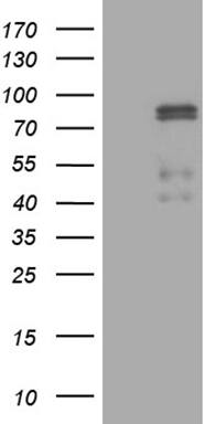 CLIP4 Antibody (OTI5D10) Western Blot;CLIP4 Antibody (OTI5D10)[NBP3-44957]-