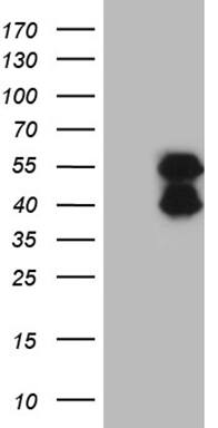 BCL7B Antibody (OTI4B10) Western Blot;BCL7B Antibody (OTI4B10)[NBP3-44964]-