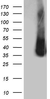 ZCCHC17 Antibody (OTI1F11) Western Blot;ZCCHC17 Antibody (OTI1F11)[NBP3-44966]-