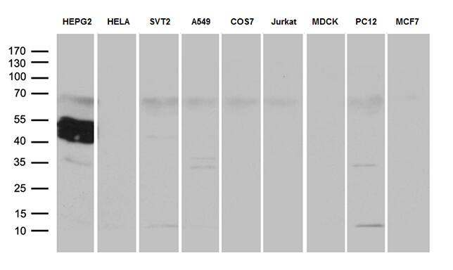 ZCCHC17 Antibody (OTI1F11) Western Blot;ZCCHC17 Antibody (OTI1F11)[NBP3-44966]-